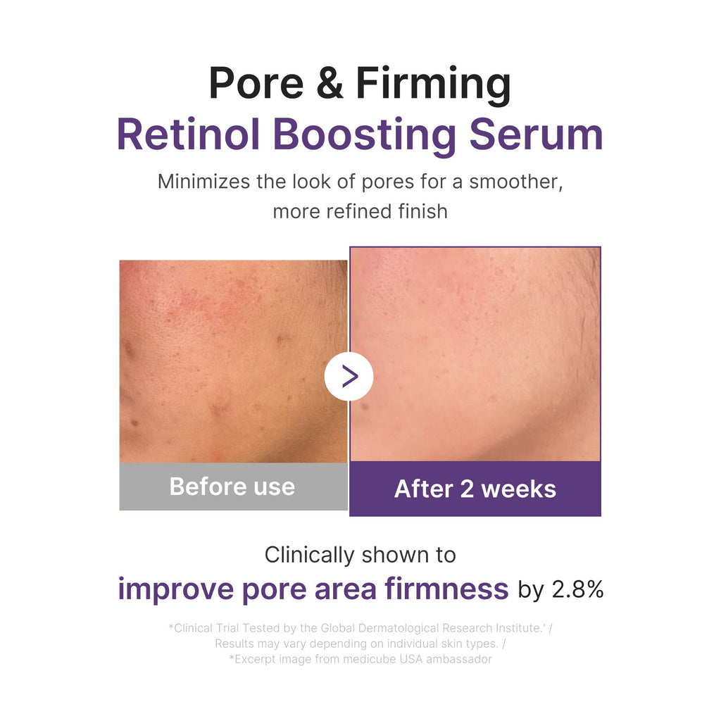 Retinol NMN Boosting Serum
